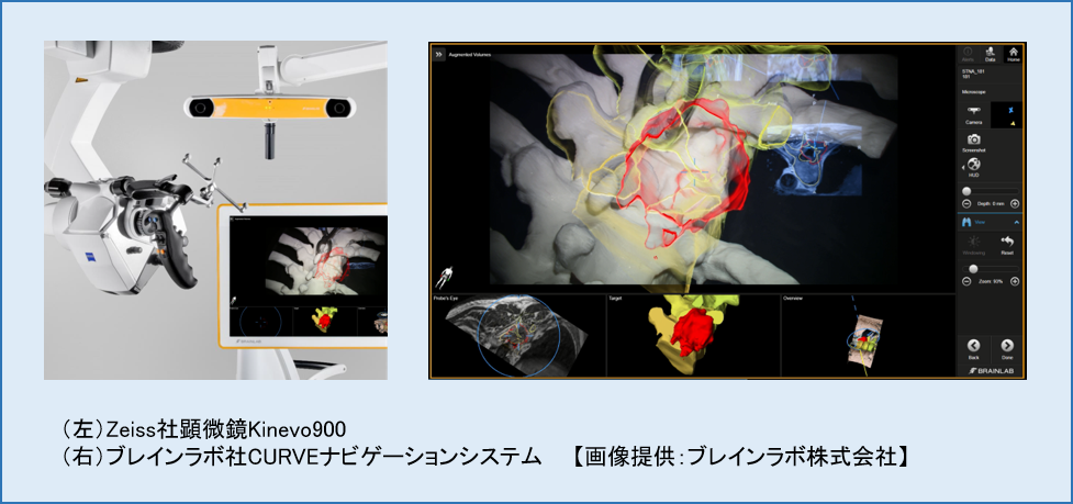 （左）Zeiss社顕微鏡Kinevo900（右）ブレインラボ社CURVEナビゲーションシステム　　【画像提供：ブレインラボ株式会社】